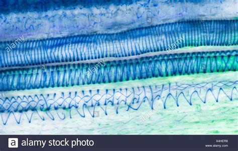 Xylem Tissue Under Microscope Micropedia
