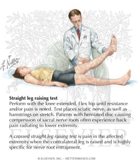 Se hace primero un test de lasegue levantando la pierna afecta del paciente. Pin Raise Lasegue S Maneuver Bragard Sign Bowstring Cram Test Hoover on Pinterest