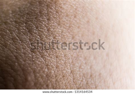 Scaling Skin Stock Photo 1314164534 Shutterstock