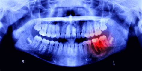 Why Do My Teeth Hurt 9 Possible Toothache Causes