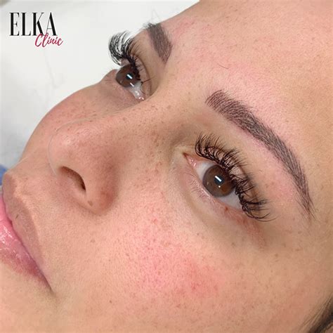 Everything About Feather Touch Brows Elka Clinic