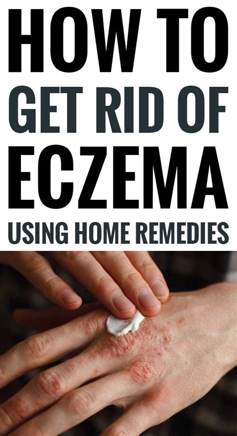 This could alleviate your clammy hand problem in the long run if you continuously wash your hands more often throughout the day. Eczema is that condition wherever skin patches become ...