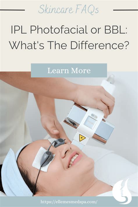 Ipl Photofacial Vs Bbl Whats The Difference January 2024