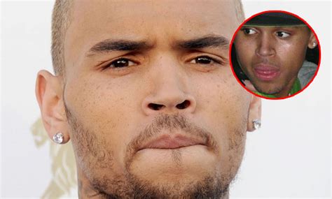 You'll have access to tons of videos and exclusive pictures. List of Stars with Herpes & STDs in 2016 - Stars with Herpes