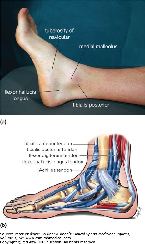 Ankle Pain Brukner And Khans Clinical Sports Medicine Injuries