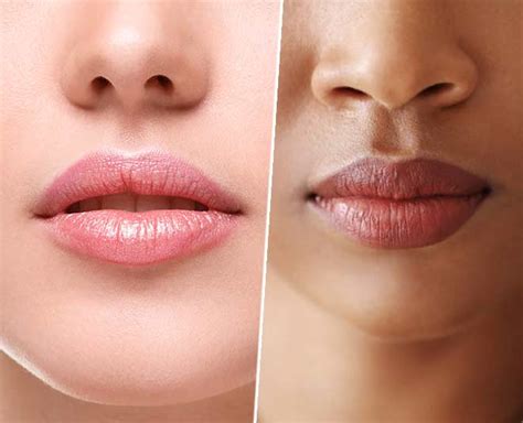 How To Treat Lip Pigmentation At Home Herzindagi