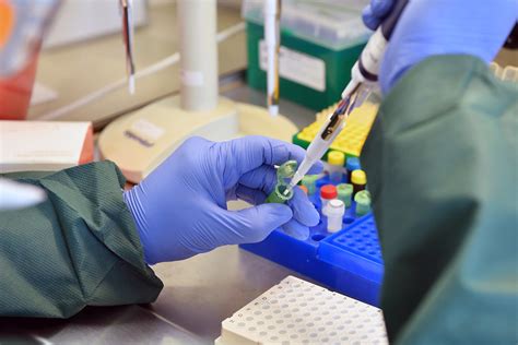 These pcr machine price are easy to operate and can be completely customized in sync with your requirements. Preparation of the RT-PCR Reaction (05811009) | COVID-19 ...