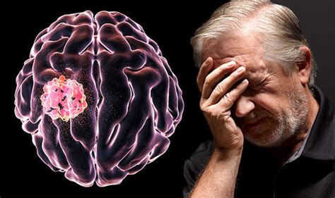 Cancer Five Early Symptoms Of A Brain Tumour You Must Be Aware Of