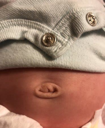 Innie Or Outie Belly Button BabyCenter