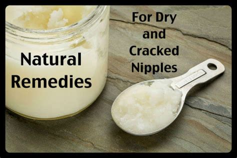3 Things That Fix Itchy Cracked Nipples