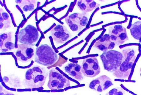 Gram Staining Gram Positive And Gram Negative Bacteria Hubpages