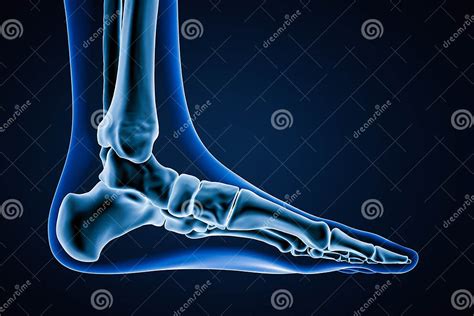 Medial View Of Accurate Human Left Foot Bones With Body Contours On