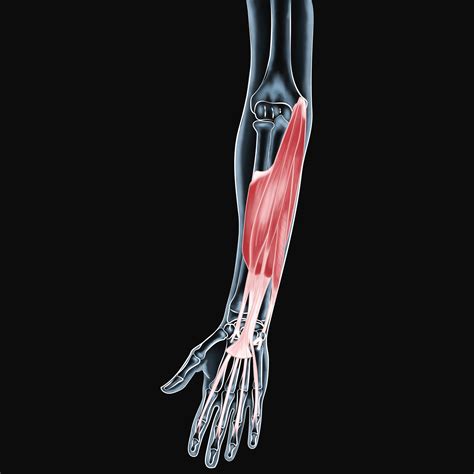 Strengthening Recovery Treating Wrist Flexor Muscle Injuries
