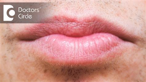 Small Tiny Bumps On Lips 💌 Bumps Inside Lips Causes Small White