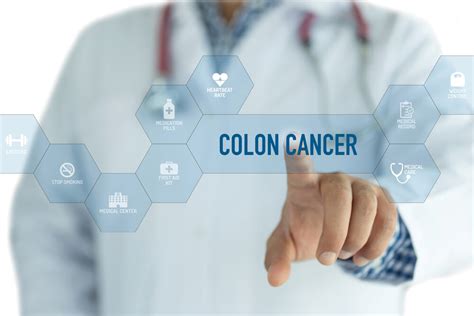Importance Of Colon Cancer Screening