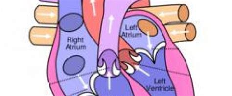 Contemporary reviews in cardiovascular medicine. Fluid in lungs after surgery | General center ...