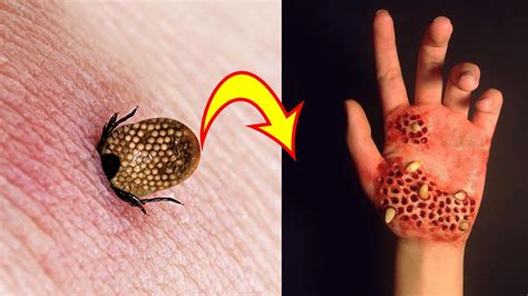 12 Most Dangerous Bugs In The World Youtube