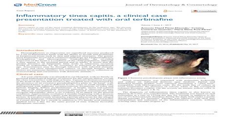 Inflammatory Tinea Capitis A Clinical Case Presentation · Tinea