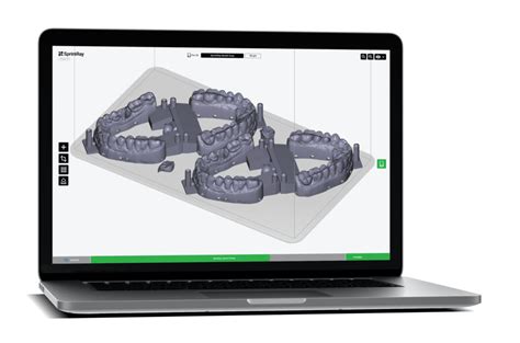 SprintRay Pro 3D Printer - Awesome Technology
