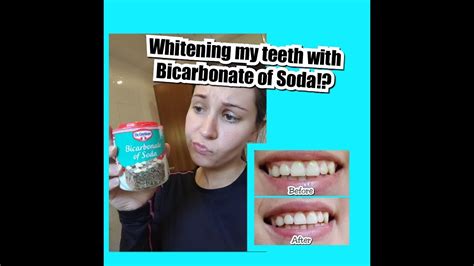 How To Whiten Teeth At Home In 2 Minutes Using Bicarbonate Of Soda To