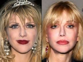 The most professional consultation will be given by our dean before any surgeries. Celebrities Before and After a Plastic Surgery (21 pics)