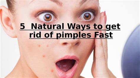 5 Natural Ways To Get Rid Of Pimples Fast Youtube