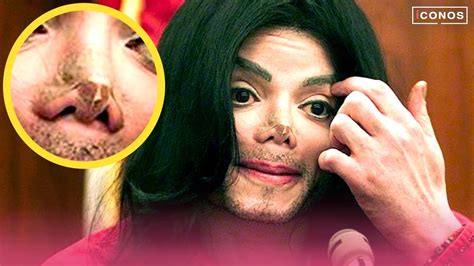 La Raz N Por La Que Michael Jackson Se Arruin La Nariz Youtube