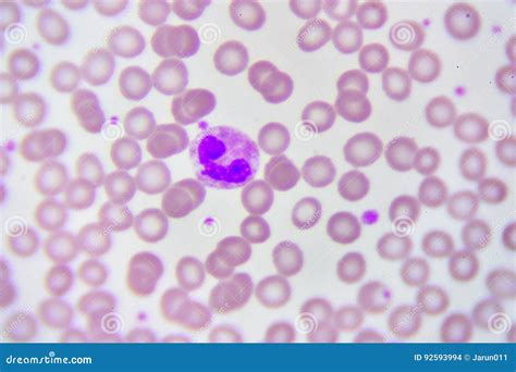 Neutrophil Cell Stock Photo Image Of Abnormal Checkup 92593994