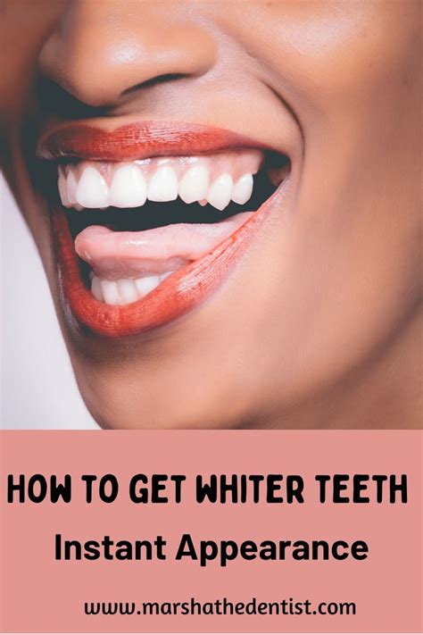 How To Get Whiter Teeth Get Whiter Teeth Lipstick Shades White