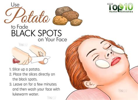 A scar refers to the tissue growth that marks the site where a wound has healed. The 25+ best Black spots on skin ideas on Pinterest ...