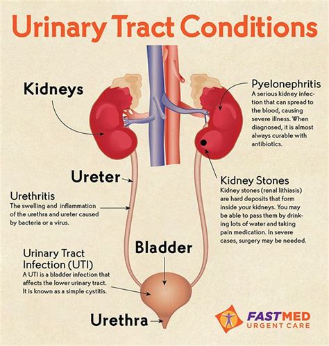 Urinary Tract Conditions Infographic Urinary Tract Urinary Tract