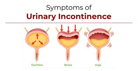 Symptoms Of Urinary Incontinence Urologist Ahmedabad