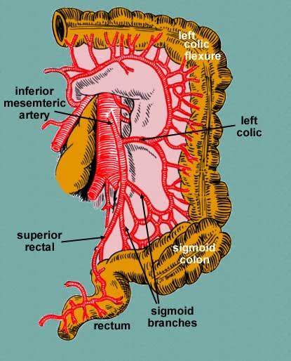 Inferior Mesenteric Artery Ima Stepwards