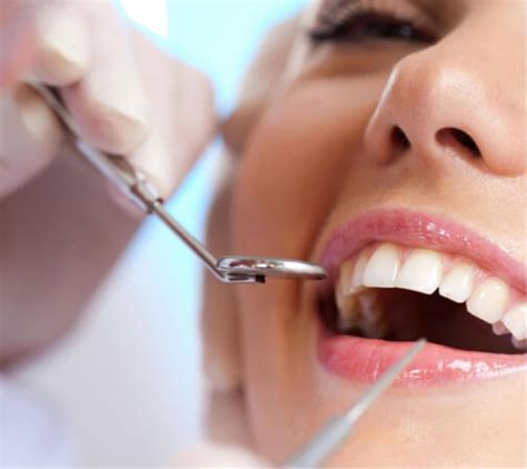 ¿conoces La Odontología Conservadora ¡salva Tus Piezas Dentales