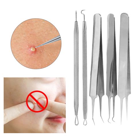 .your blackheads but are unsure how to use a blackhead remover (also know as blackhead extractor), let's just say a blackhead extractor is one of the gently press the tool from side to side applying a little pressure; VGEBY Blackhead Remover Kit, 5-in-1 Pimple Extractor Acne ...