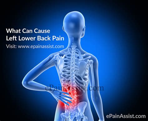 Lower Back Pain Low Back Pain