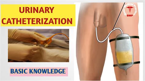 Urinary Catheterization Foleys Catheterization Insertion Procedure
