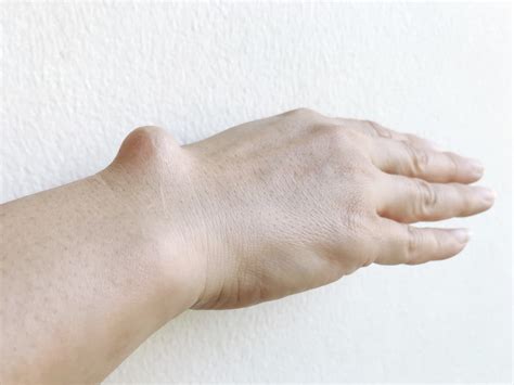 With A Flick Of The Wrist Top Causes Of Wrist Pain Facty Health