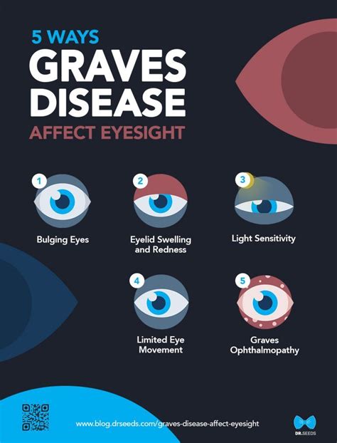 5 Ways Graves Disease Affect Your Eyesight Infographic Dr Seeds Graves Disease Disease