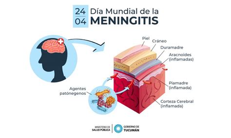 Día Mundial Contra La Meningitis Ministerio De Salud Pública De Tucumán