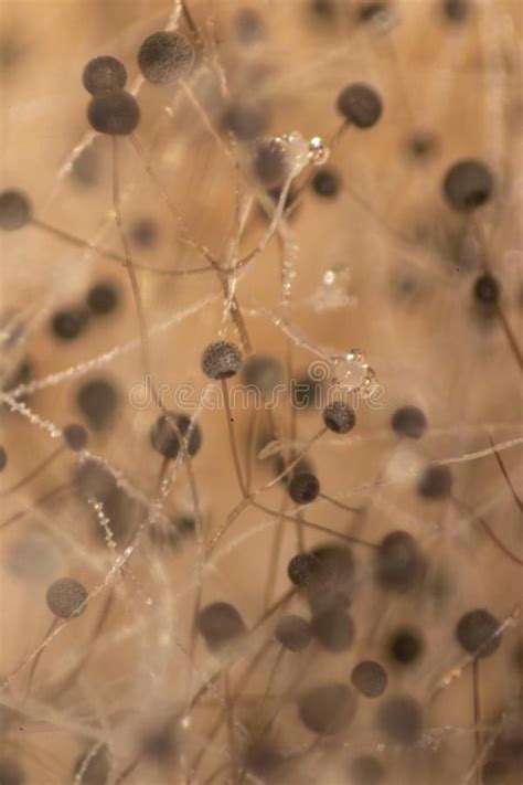 Mold spores under the microscope photo id library of common molds found in buildings. Rhizopus bread mold under the microscope. Rhizopus bread ...
