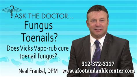 Having foot fungus is a common condition caused by microscopic organisms that grow in warm, moist areas. Does Vicks VapoRub Cure Toenail Fungus? Chicago ...