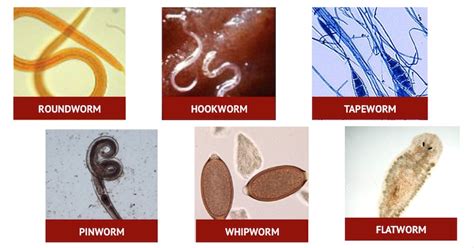 Worms In Humans Human Body Greenwaysome