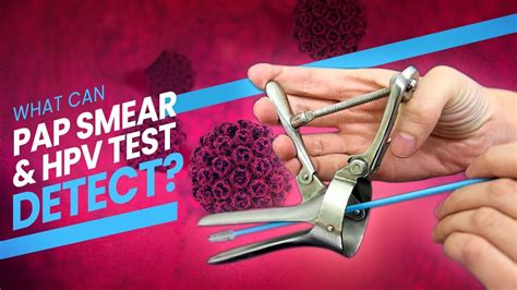 Pap Smear Pap Test And Hpv Test A Step By Step Guide D At What Happens During The Test