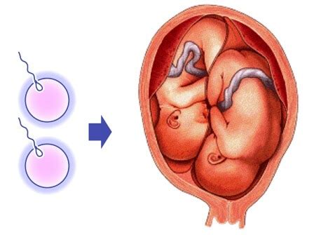 Lalu bagaimana cara agar mendapatkan anak kembar? Cara Menjaga Kehamilan Bayi Kembar Agar Tetap Sehat