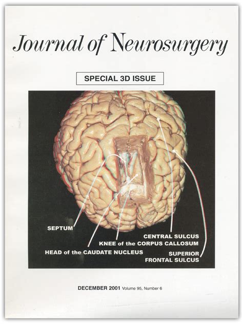 Give Neurosurgery A Place To Stand In Journal Of Neurosurgery Volume