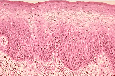 Stratified Squamous Epithelium Rounder Basal Cells Flatter Cells