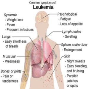 This leads to such symptoms as a sensation of pressure behind the breastbone, shortness of breath, chest pain and difficulty swallowing. Leukemia symptoms, types, causes and risk factors ...
