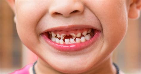Dua jarinya sekaligus masuk dalam vaginaku. Buat Sapuan Fluoride Untuk Cegah Karies Gigi Anak Dari ...