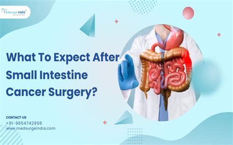 what to expect after small intestine cancer surgery detectmind